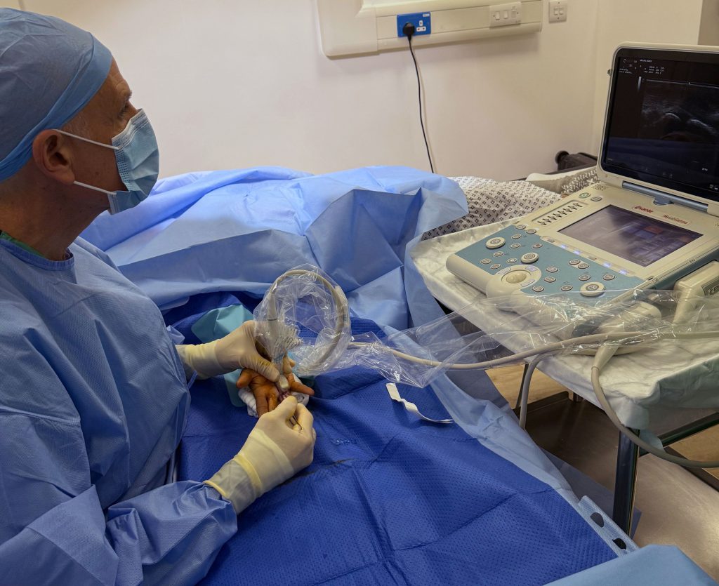 Keyhole trigger finger surgery (ultrasound guided)